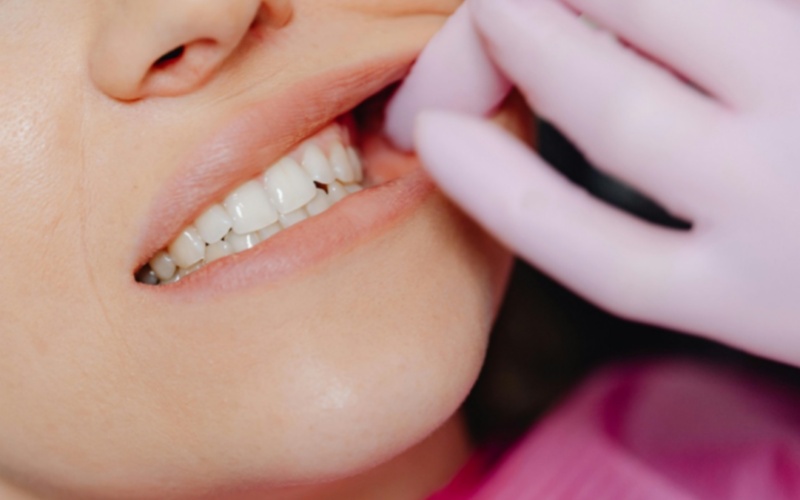 莱沃口腔‖拔牙，是一件风险很大的事吗？