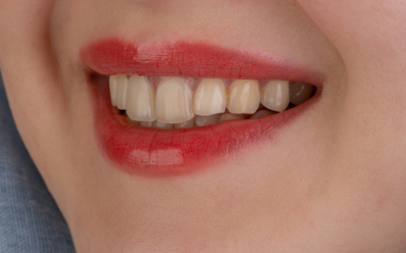 莱沃口腔‖美食当前，却只能咽口水？缺牙的苦，有谁能懂？